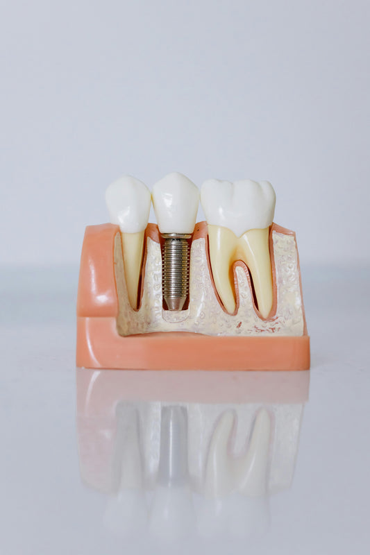 The Peri-Implantitis Microbiome: A Review